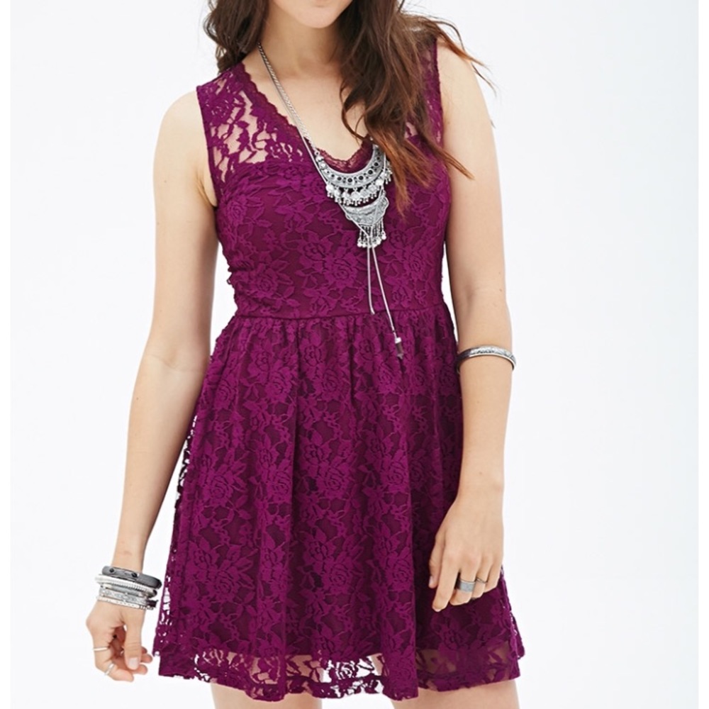 •forever 21• lace dress